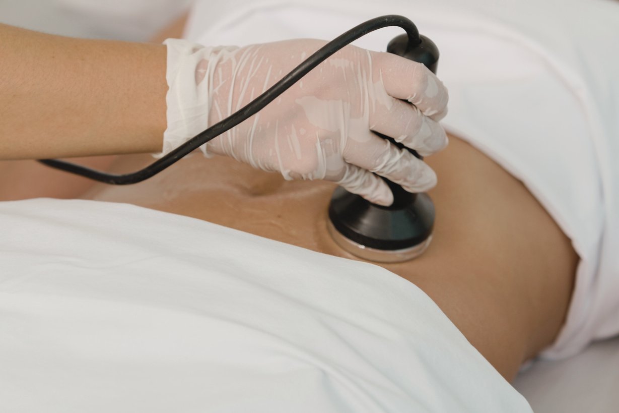 a women getting a Cavitation Body Treatment